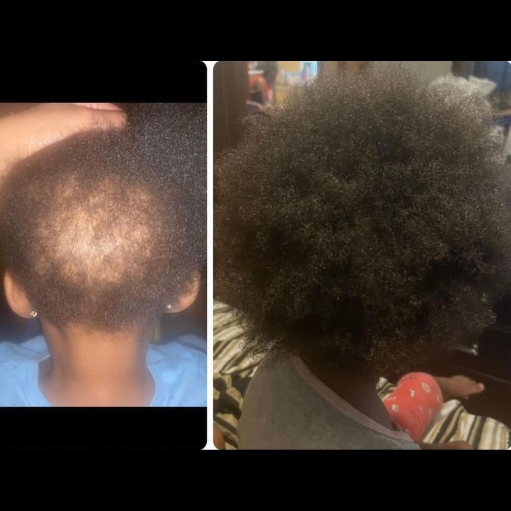 Homemade Hair Growth Oil